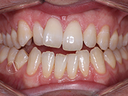 Progressive - Ali Orthodontics Dental