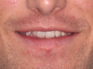 Progressive - Ali Orthodontics Dental