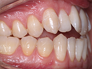 Progressive - Ali Orthodontics Dental