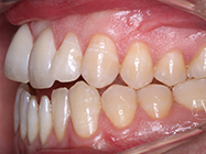 Progressive - Ali Orthodontics Dental