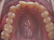 Progressive - Ali Orthodontics Dental