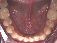 Progressive - Ali Orthodontics Dental