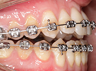 Progressive - Ali Orthodontics Dental