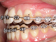 Progressive - Ali Orthodontics Dental