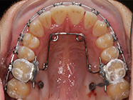 Progressive - Ali Orthodontics Dental