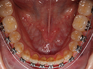 Progressive - Ali Orthodontics Dental