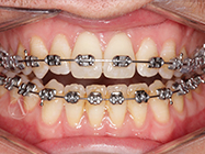 Progressive - Ali Orthodontics Dental