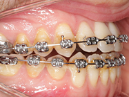 Progressive - Ali Orthodontics Dental