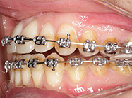 Progressive - Ali Orthodontics Dental