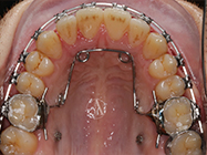 Progressive - Ali Orthodontics Dental