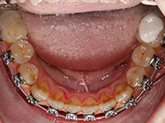 Progressive - Ali Orthodontics Dental