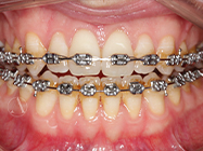 Progressive - Ali Orthodontics Dental