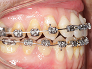 Progressive - Ali Orthodontics Dental