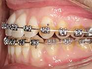 Progressive - Ali Orthodontics Dental