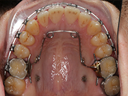 Progressive - Ali Orthodontics Dental