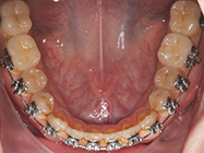 Progressive - Ali Orthodontics Dental