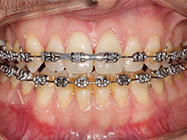 Progressive - Ali Orthodontics Dental