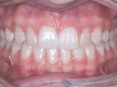 After - Ali Orthodontics Dental