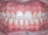 After - Ali Orthodontics Dental