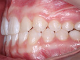 After - Ali Orthodontics Dental