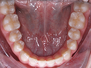 After - Ali Orthodontics Dental