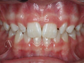 Before - Ali Orthodontics Dental