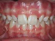 Before - Ali Orthodontics Dental