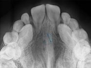 Before - Ali Orthodontics Dental
