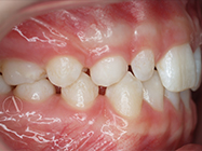 Before - Ali Orthodontics Dental
