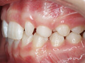 Before - Ali Orthodontics Dental