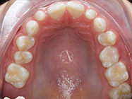 Before - Ali Orthodontics Dental