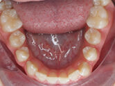 Before - Ali Orthodontics Dental