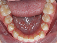 Before - Ali Orthodontics Dental