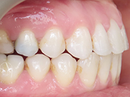 Progressive - Ali Orthodontics Dental