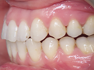 Progressive - Ali Orthodontics Dental