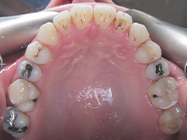 Progressive - Ali Orthodontics Dental