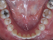 Progressive - Ali Orthodontics Dental