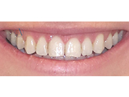 Progressive - Ali Orthodontics Dental