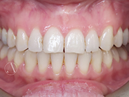 Progressive - Ali Orthodontics Dental