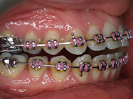 Progressive - Ali Orthodontics Dental