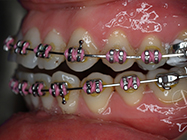 Progressive - Ali Orthodontics Dental