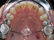 Progressive - Ali Orthodontics Dental