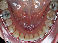 Progressive - Ali Orthodontics Dental