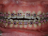 Progressive - Ali Orthodontics Dental