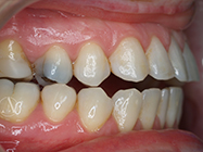 Progressive - Ali Orthodontics Dental