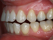 Progressive - Ali Orthodontics Dental