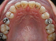 Progressive - Ali Orthodontics Dental