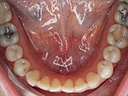 Progressive - Ali Orthodontics Dental