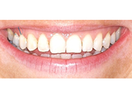 Progressive - Ali Orthodontics Dental