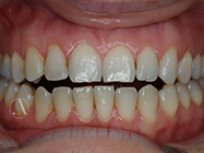 Progressive - Ali Orthodontics Dental